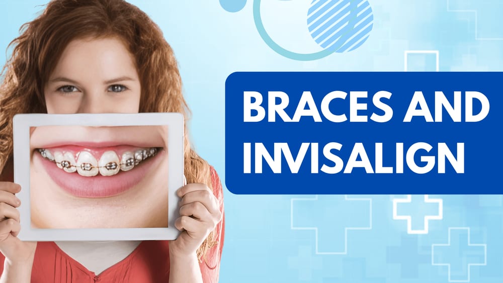 braces and invisalign treatment in Jaipur