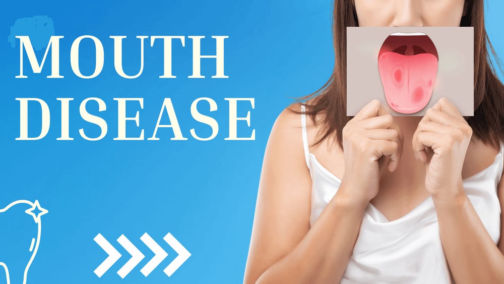 Mouth Disease Treatment in Jaipur at Manglam Dental Hospital