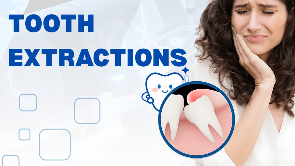 Tooth Extraction in Jaipur at Manglam Dental Hospital
