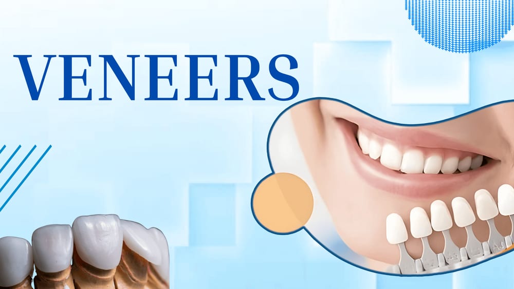 dental veneers in Jaipur